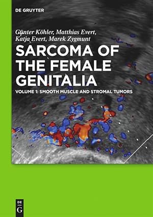 Immagine del venditore per Sarcoma of the female genitalia 1 venduto da moluna