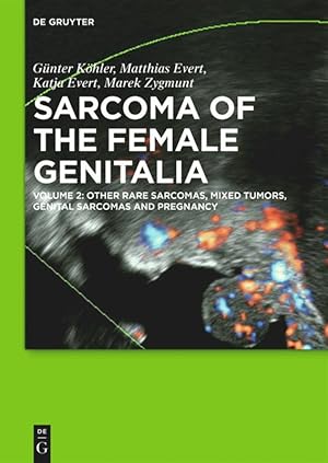 Immagine del venditore per Sarcoma of the female genitalia 2 venduto da moluna