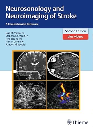Seller image for Neurosonology and Neuroimaging of Stroke for sale by moluna