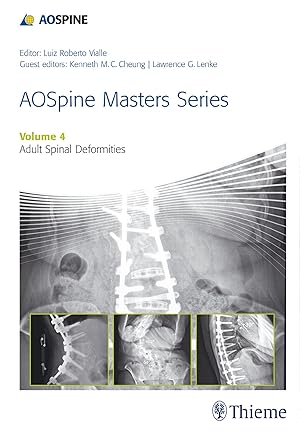 Seller image for AOSpine Master Series, Vol. 4: Adult Spinal Deformities for sale by moluna