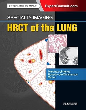 Bild des Verkufers fr Specialty Imaging: HRCT of the Lung zum Verkauf von moluna