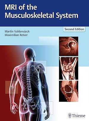 Image du vendeur pour MRI of the Musculoskeletal System mis en vente par moluna