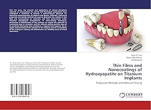 Seller image for Thin Films and Nanocoatings of Hydroxyapatite on Titanium Implants for sale by moluna