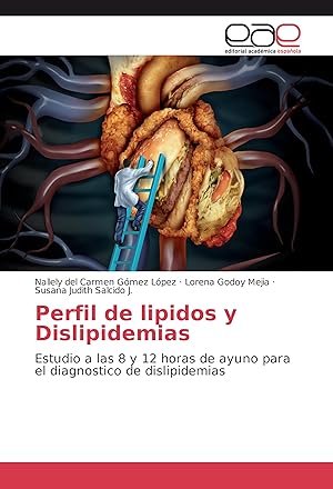Immagine del venditore per Perfil de lipidos y Dislipidemias venduto da moluna