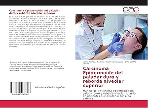 Bild des Verkufers fr Carcinoma Epidermoide del paladar duro y reborde alveolar superior zum Verkauf von moluna