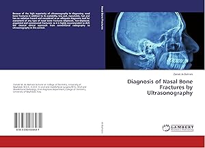 Seller image for Diagnosis of Nasal Bone Fractures by Ultrasonography for sale by moluna