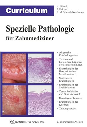 Bild des Verkufers fr Curriculum Spezielle Pathologie fr Zahnmediziner zum Verkauf von moluna