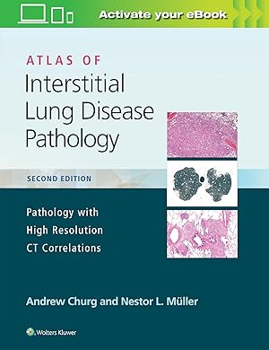 Bild des Verkufers fr Atlas of Interstitial Lung Disease Pathology zum Verkauf von moluna