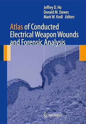 Bild des Verkufers fr Atlas of Conducted Electrical Weapon Wounds and Forensic Analysis zum Verkauf von moluna