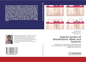Seller image for Support System of Overdentures: Roots and Implants for sale by moluna