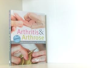 Arthritis & Arthrose: erkennen, vorbeugen, behandeln