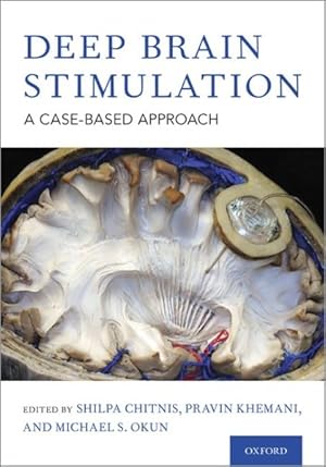 Seller image for Deep Brain Stimulation : A Case-Based Approach for sale by GreatBookPrices