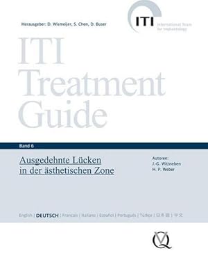 Seller image for ITI Treatment Guide Band 6: Ausgedehnte Lcken in der sthetischen Zone : Ausgedehnte Lcken in der sthetischen Zone for sale by AHA-BUCH