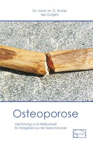 Seller image for Osteoporose for sale by moluna