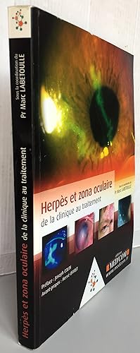 Seller image for Herps et zona oculaire : De la clinique au traitement for sale by Librairie Thot