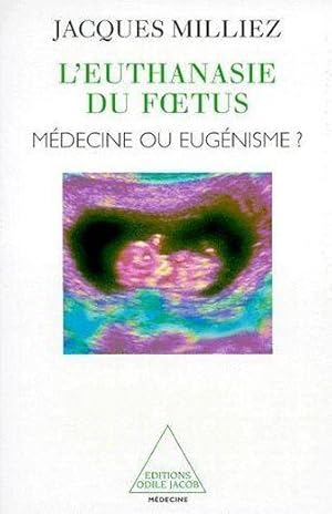 L'euthanasie du foetus