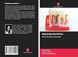 Bild des Verkufers fr Implantes Dentrios zum Verkauf von moluna