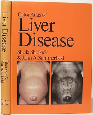 Bild des Verkufers fr Color Atlas of Liver Disease zum Verkauf von SmarterRat Books