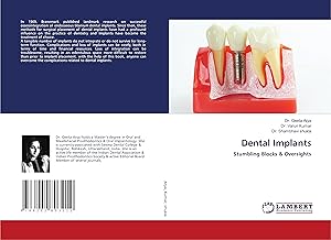 Bild des Verkufers fr Dental Implants zum Verkauf von moluna