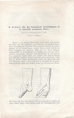 Om den konstgorda missbildningen af de kinesiska qvinnornas fötter. (About the artificial deformi...