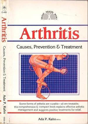 Seller image for Arthritis Causes, prevention & treatment for sale by Biblioteca di Babele