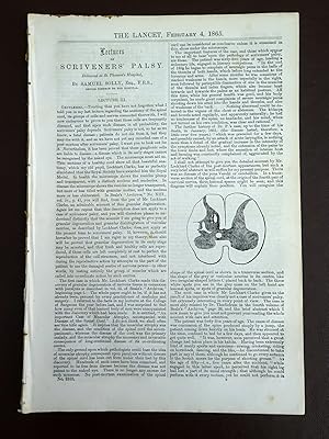 Image du vendeur pour The Lancet. 4 February 1865. Scrivenor's Palsy (pt 3), Excision of the Tongue, Prevalent Epidemic Disease, Trephining 6 Cases of Compound Fracture of Skull. Winter Cough. Etc. mis en vente par Tony Hutchinson