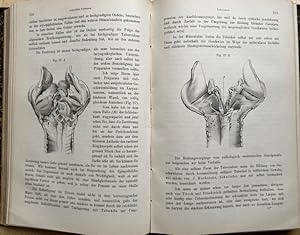 Imagen del vendedor de Vorlesungen ber die Krankheiten des Kehlkopfes : I. Band.: Der Luftrhre, der Nase und des Rachens. Mit 111 Holzschnitten. a la venta por Treptower Buecherkabinett Inh. Schultz Volha