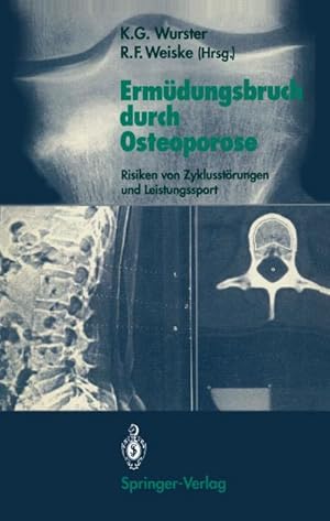 Immagine del venditore per Ermdungsbruch durch Osteoporose venduto da BuchWeltWeit Ludwig Meier e.K.