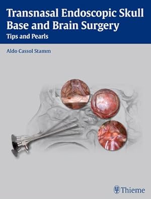 Seller image for Transnasal Endoscopic Skull Base and Brain Surgery : Tips and Pearls for sale by GreatBookPricesUK