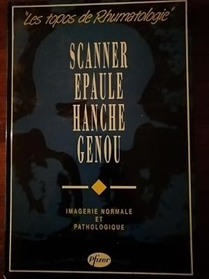 Scanner Epaule Hanche Cou Imagerie normale et pathologique Topos de rhumatologie 1992 - - Médecin...