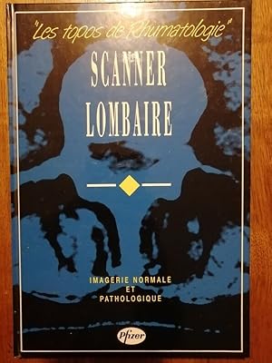 Scanner Lombaire Imagerie normale et pathologique Topos de rhumatologie 1991 - - Médecine Techniq...