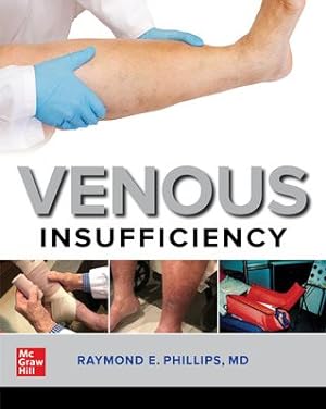 Seller image for Venous Insufficiency for sale by GreatBookPrices