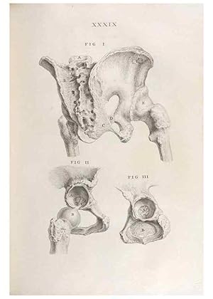 Bild des Verkufers fr Reproduccin/Reproduction 48832441118: Osteographia, or the Anatomy of the Bones. London,1733. zum Verkauf von EL BOLETIN