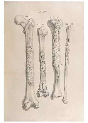 Seller image for Reproduccin/Reproduction 48832980897: Osteographia, or the Anatomy of the Bones. London,1733. for sale by EL BOLETIN