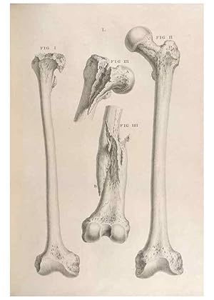 Seller image for Reproduccin/Reproduction 48832811051: Osteographia, or the Anatomy of the Bones. London,1733. for sale by EL BOLETIN