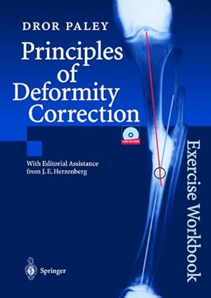 Bild des Verkufers fr Principles of Deformity Correction : Exercise Workbook zum Verkauf von AHA-BUCH GmbH