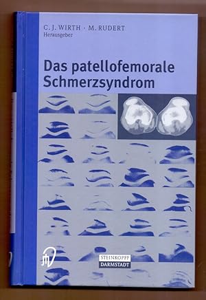 Imagen del vendedor de Das patellofemorale Schmerzsyndrom. a la venta por Die Wortfreunde - Antiquariat Wirthwein Matthias Wirthwein