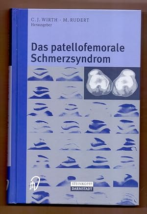 Bild des Verkufers fr Das patellofemorale Schmerzsyndrom. zum Verkauf von Die Wortfreunde - Antiquariat Wirthwein Matthias Wirthwein