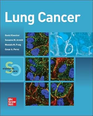 Image du vendeur pour Lung Cancer : Standards of Care mis en vente par GreatBookPricesUK