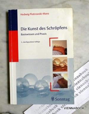 Die Kunst des Schröpfens.