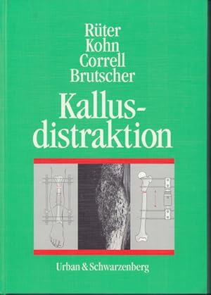 Kallusdistraktion - mit Tabellen