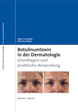 Bild des Verkufers fr Botulinumtoxin in der Dermatologie : Grundlagen und praktische Anwendung. zum Verkauf von Antiquariat Thomas Haker GmbH & Co. KG