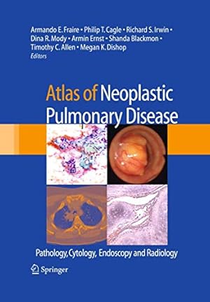 Image du vendeur pour Atlas of Neoplastic Pulmonary Disease: Pathology, Cytology, Endoscopy and Radiology mis en vente par Libro Co. Italia Srl