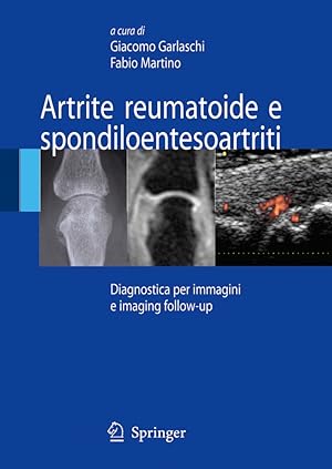 Immagine del venditore per Artrite reumatoide e spondiloentesoartriti venduto da Libro Co. Italia Srl