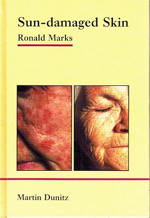 Seller image for Sun-Damaged Skin Pocketbook for sale by Z-A LLC