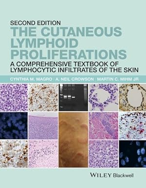Bild des Verkufers fr Cutaneous Lymphoid Proliferations : A Comprehensive Textbook of Lymphocytic Infiltrates of the Skin zum Verkauf von GreatBookPricesUK