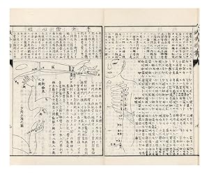 Shinkyu shisho [Illustrated Explanation of the Locations of Acupuncture Points]