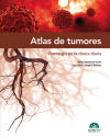 Atlas de tumores. Oncología en la clínica diaria