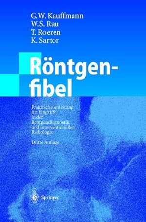 Bild des Verk�ufers f�r R�ntgenfibel : Praktische Anleitung f�r Eingriffe in der R�ntgendiagnostik und interventionellen Radiologie zum Verkauf von AHA-BUCH GmbH