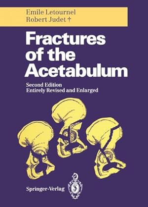 Seller image for Fractures of the Acetabulum for sale by AHA-BUCH GmbH